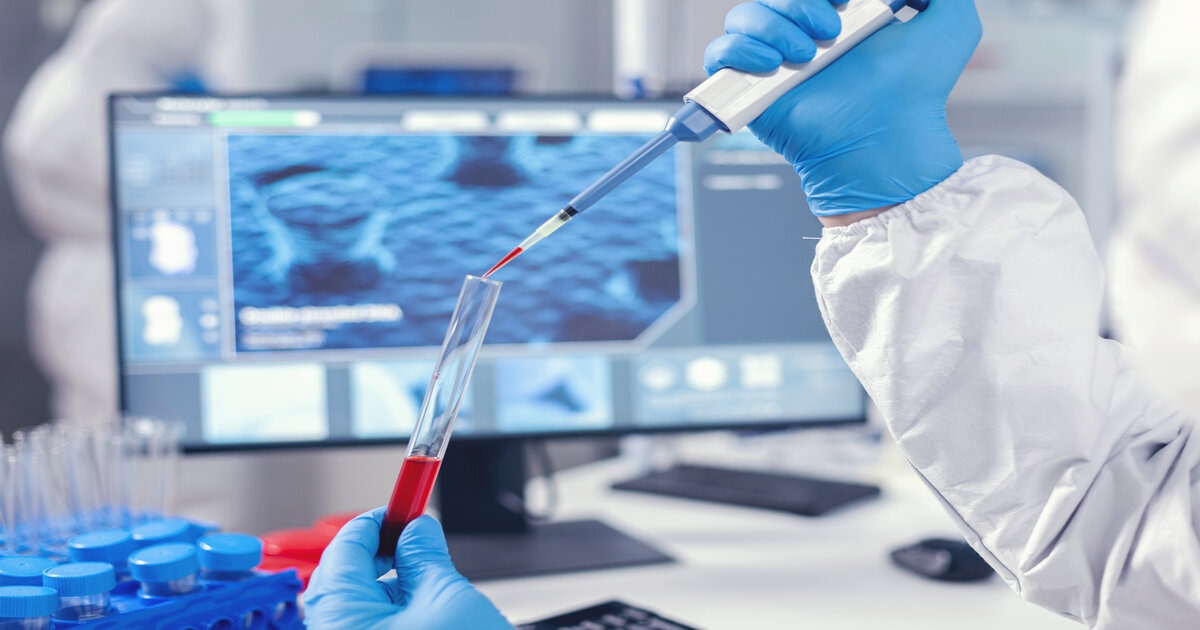 https://bioaro.com/storage/227/medical-researcher-dripping-blood-into-test-tube-from-micropipette-doctor-working-with-various-bacteria-tissue-pharmaceutical-research-antibiotics-against-covid19-(1).jpg